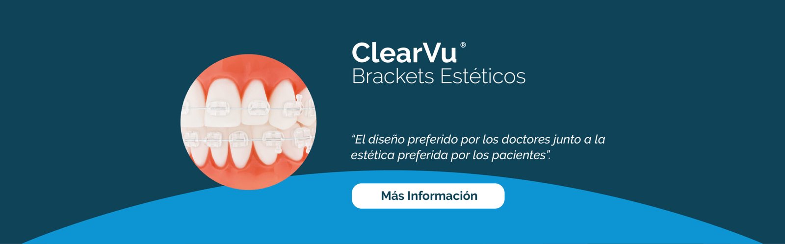 ClearVu. Brackets estéticos. El diseño preferido por los doctores junto a la estética preferida por los pacientes. Más información.