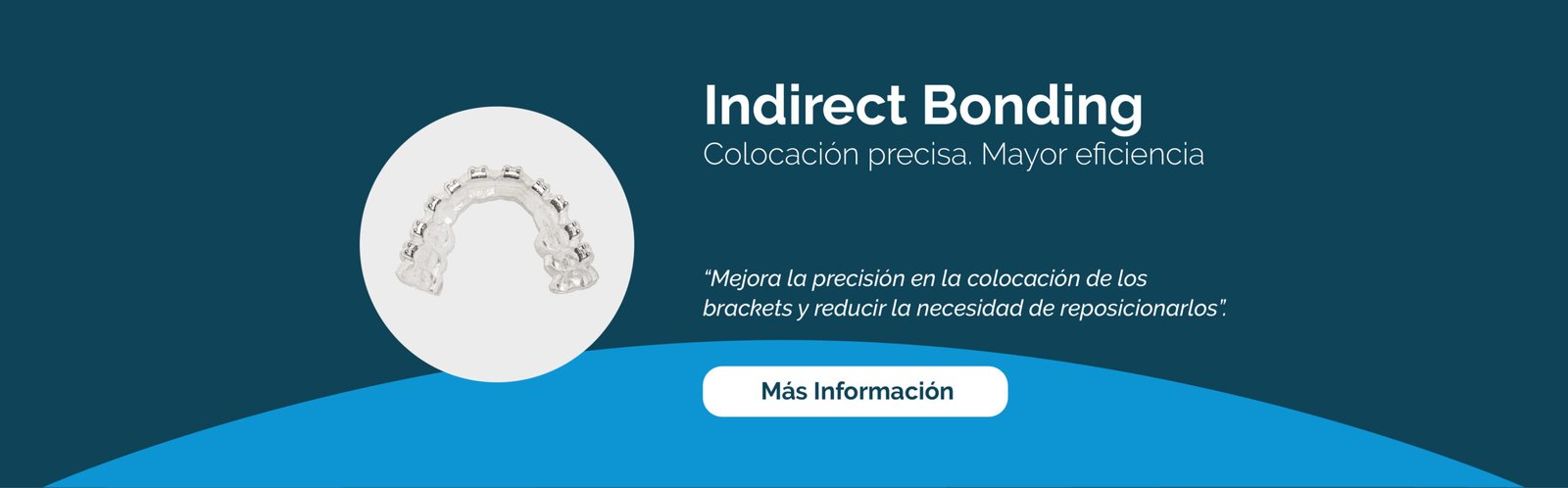 Indirect Bonding. Colocación precisa. Mayor eficiencia. Mejora la precisión en la colocación de los brackets y reducir la necesidad de reposicionarlos. Más información.